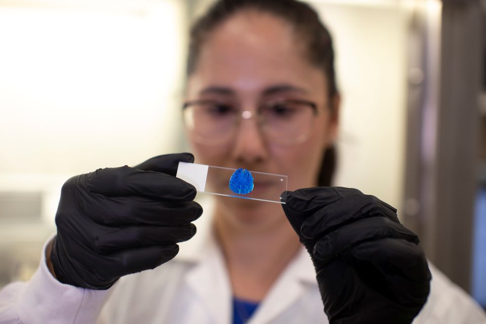 Examen de un modelo 3D de un tumor maligno, como parte de una investigacion de cancer cerebral.